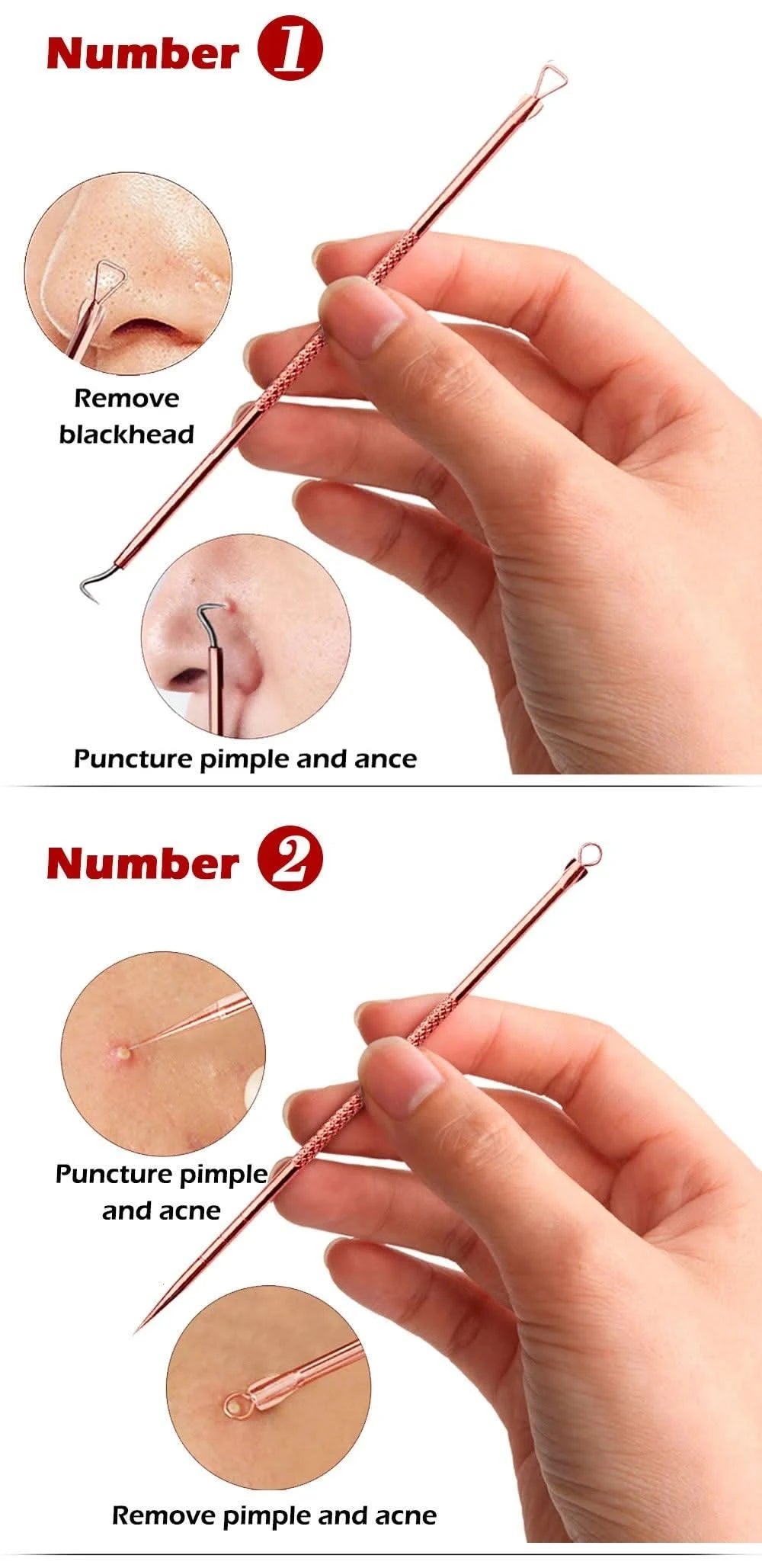 4PCS Acne Blackhead Comedone Tool Set for Clear Skin Clean Vanilla Store