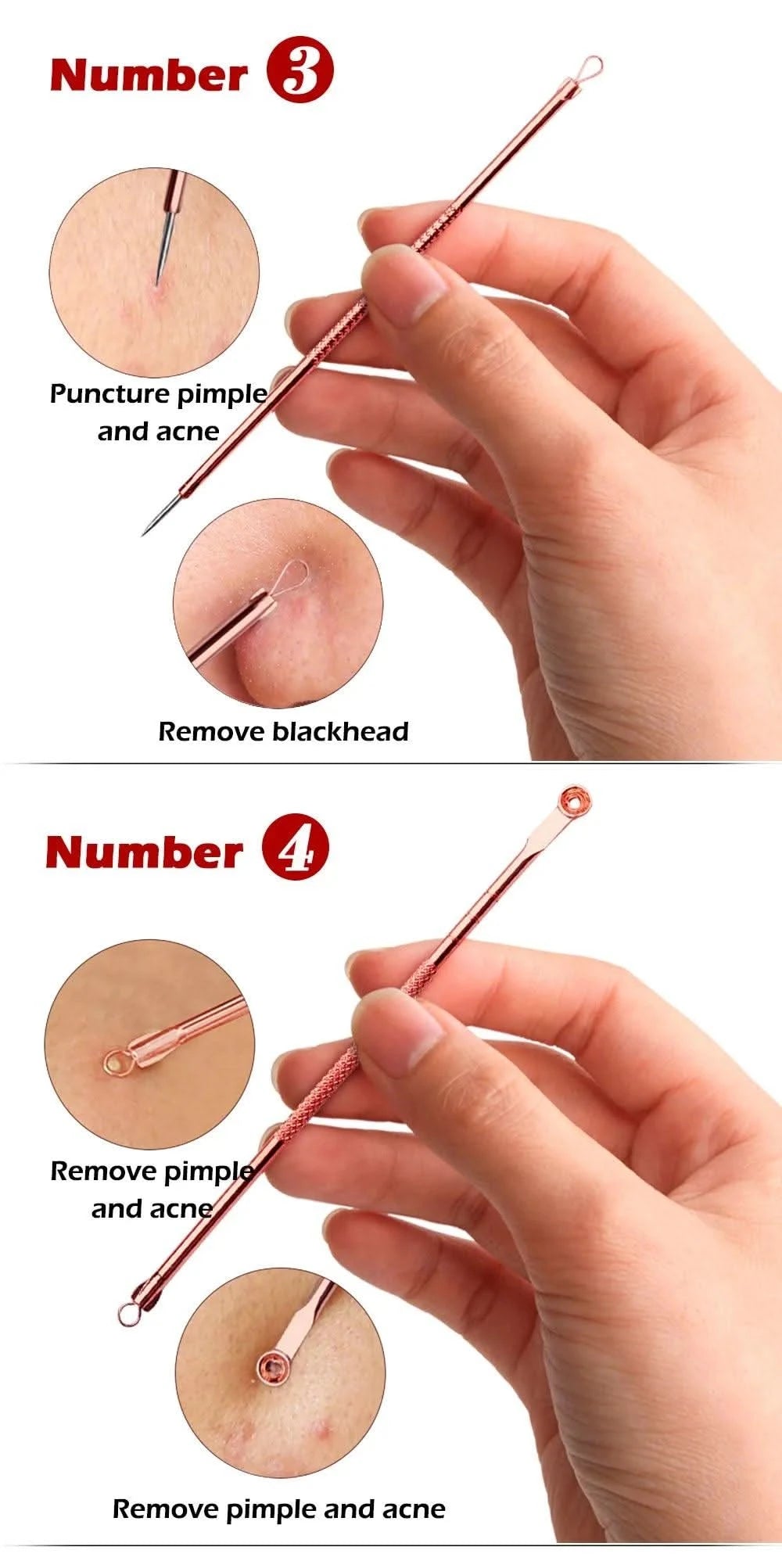 4PCS Acne Blackhead Comedone Tool Set for Clear Skin Clean Vanilla Store