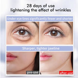 New 360° Face Eye Beauty Device Anti-Aging Wand