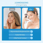 Mini HIFU Machine for Youthful Skin Lifting Device  Clean Vanilla Store