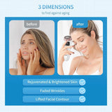 Mini HIFU Machine for Youthful Skin Lifting Device  Clean Vanilla Store