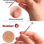 4PCS Acne Blackhead Comedone Tool Set for Clear Skin  Clean Vanilla Store